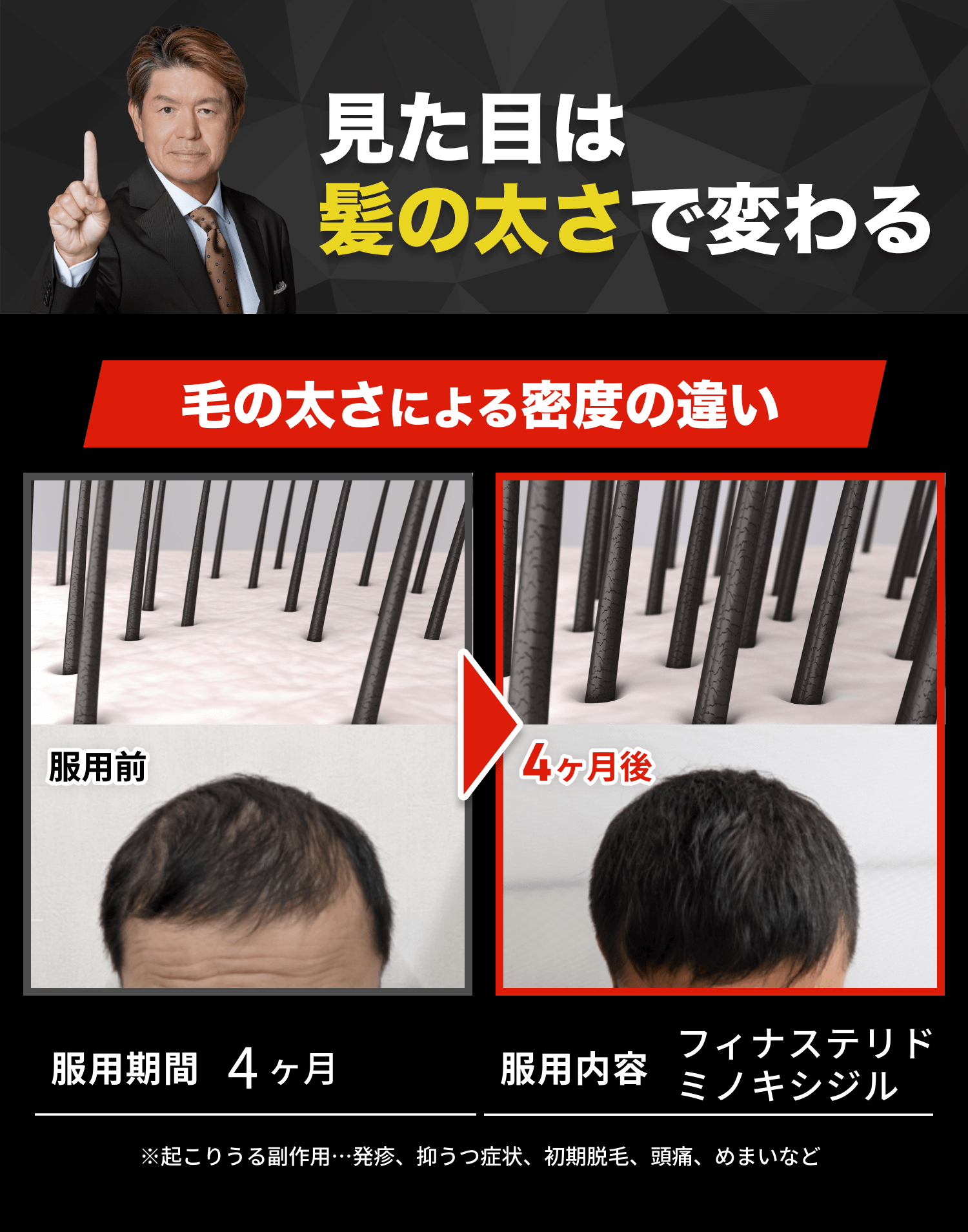 見た目は神の太さで変わる