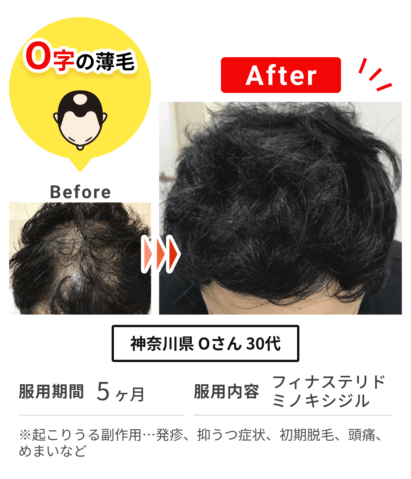 神奈川県 Oさん 30代 の症例