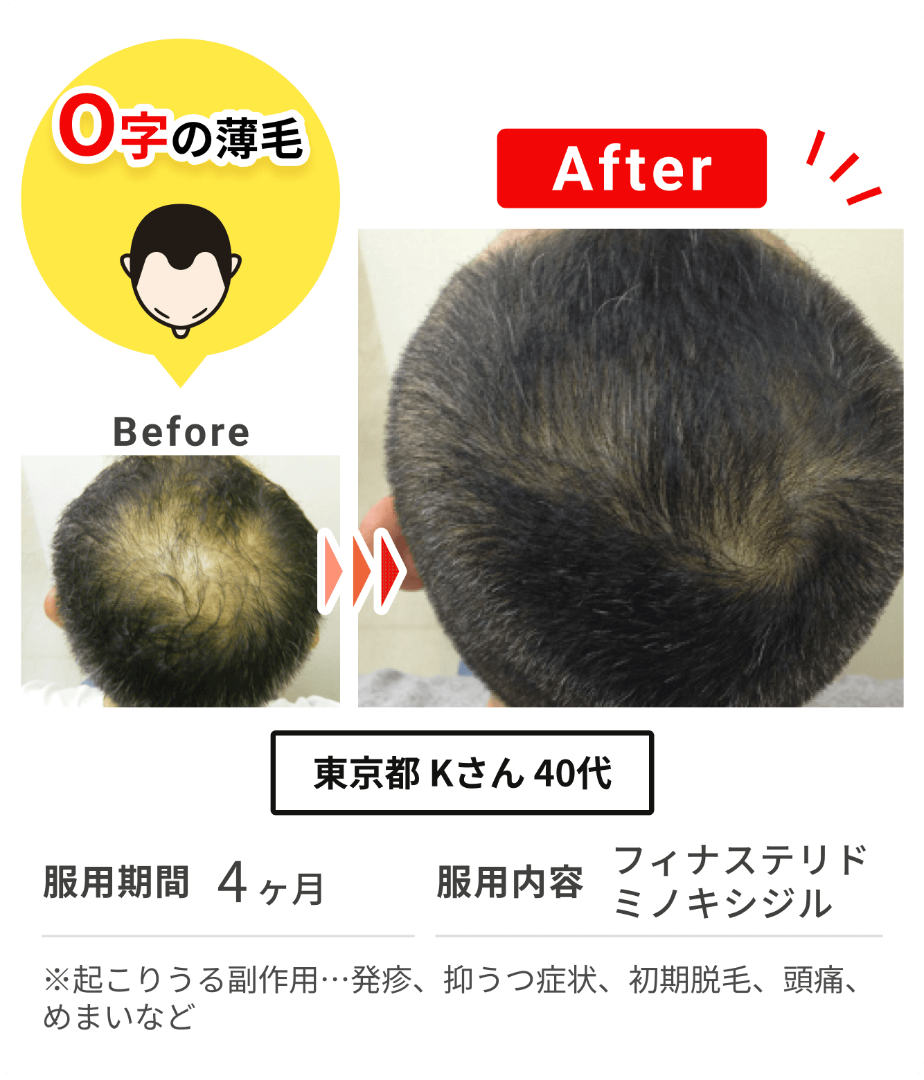 東京都 Kさん 40代 の症例