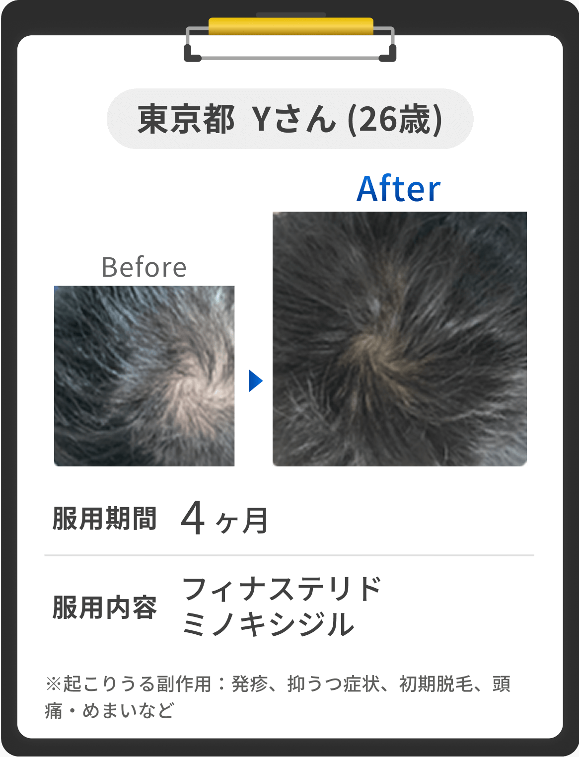 東京都 Yさん 26歳 の症例