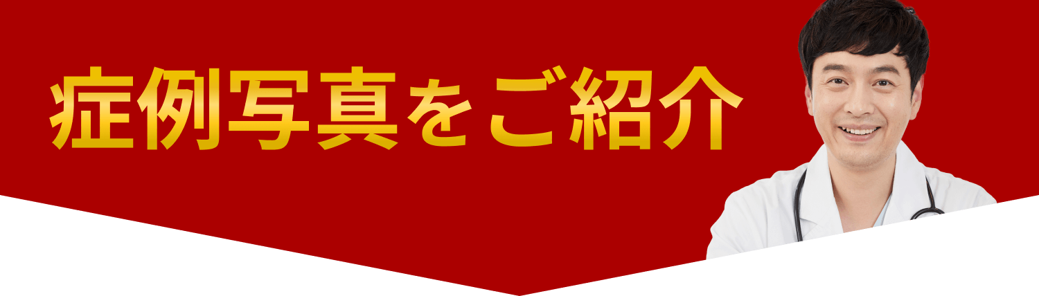 症例写真のご紹介